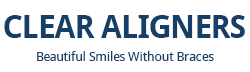 Invisalaign, the clear alternative to braces