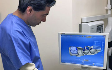 Dr. Shay Operating Cerec Cad Cam